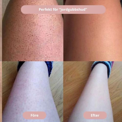 PureShave – Vergessen Sie lästige rote Punkte!